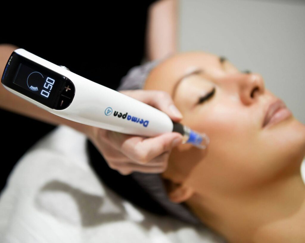 dermapen-4-microneedling
